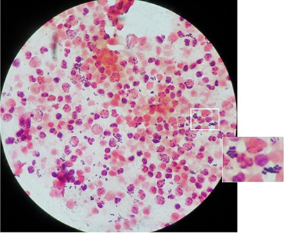 Fig 6